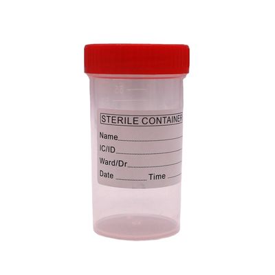 Coppa di raccolta di feci di plastica in PP da 50 ml/60 ml per la bottiglia di campionamento nelle forniture di laboratorio